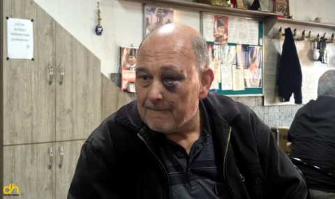 61 yaşındaki adama saldırarak darbettiler